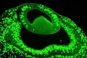 Proliferating cells in the eye of E4 chick embryo using BrdU staining