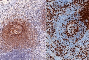 Immunohistochemistry