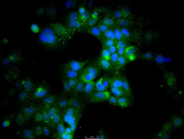 Fluorescent staining of perinuclear ANF and nuclear DAPI in the presence of HL-screened FBS