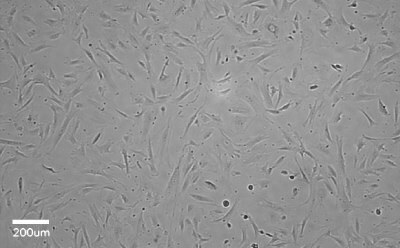 Phase contrast microscopy image of stellate cells. Light grey square with dark grey dots and elongated dark grey rectangles representing the cells. 