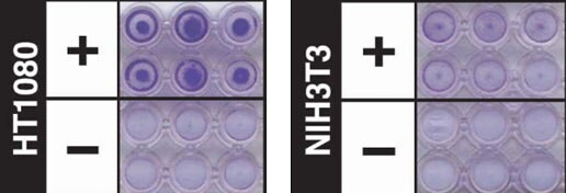 Cell invasion assay