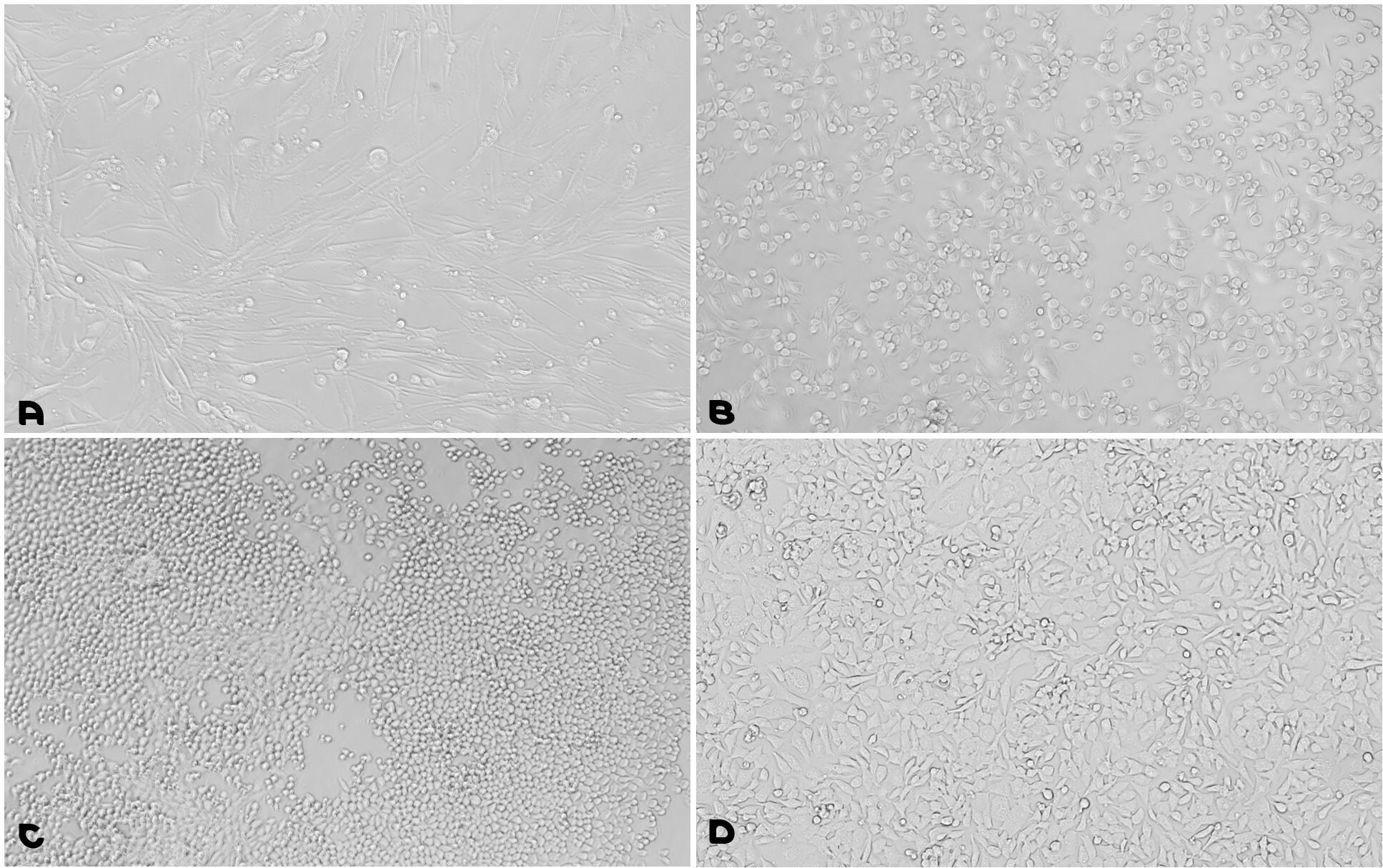 Microscopy images of cell adhesion with a fibronectin-gelatin coating solution