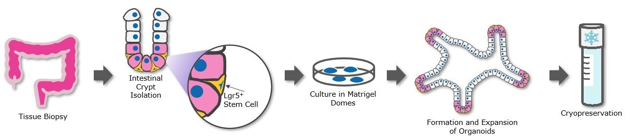 Isolation and cryopreservation of patient-derived organoids (PDOs) can be used to generate organoid biobanks.