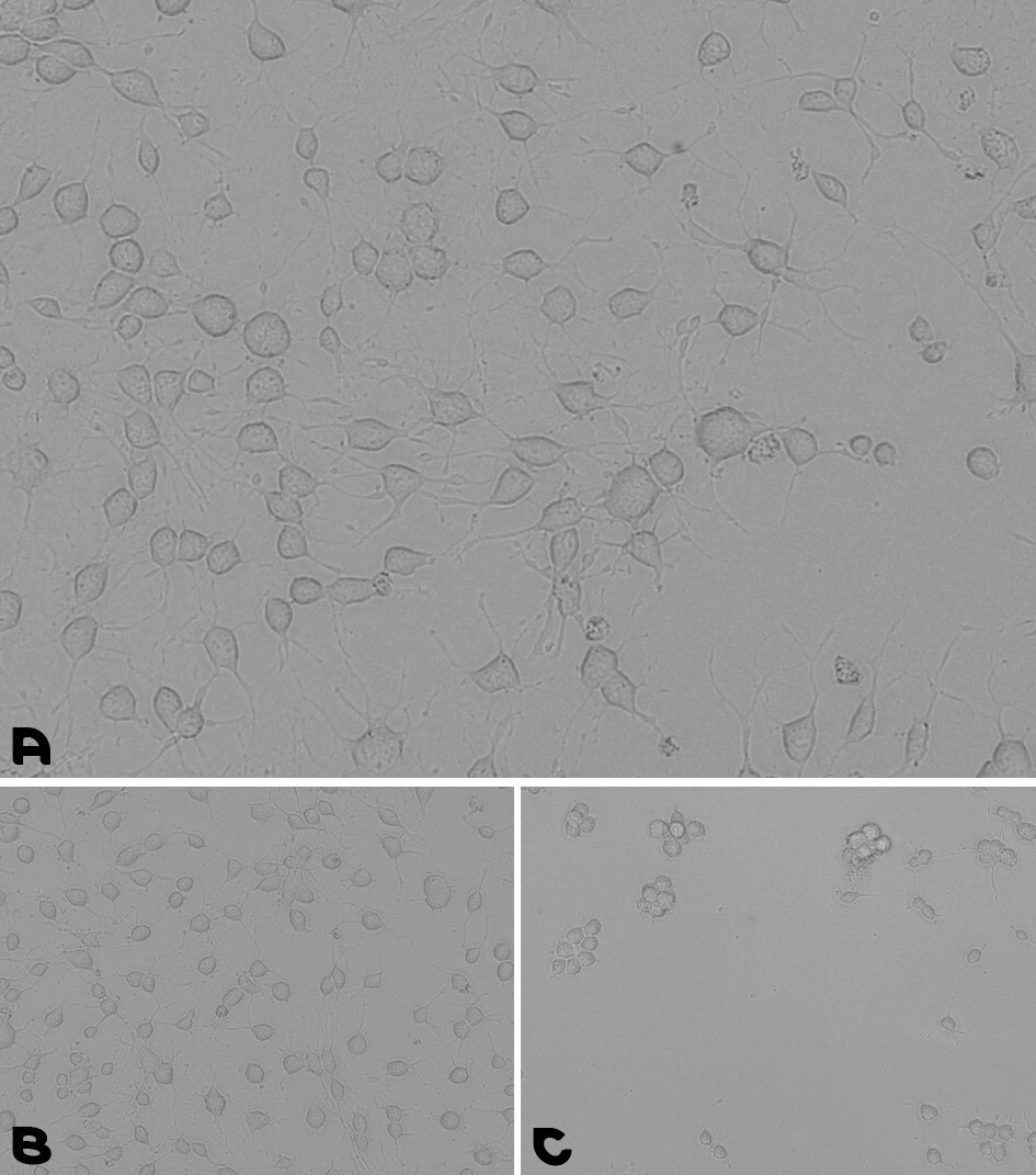 Microscopy images of cell adhesion during a neural stem cells culturing assay