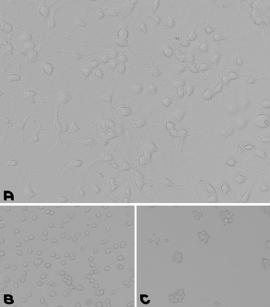 Microscopy images of cell adhesion during a neural stem cells culturing assay