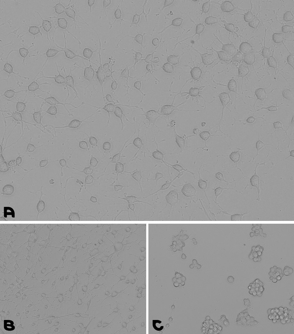 Microscopy images of cell adhesion during a neural stem cells culturing assay