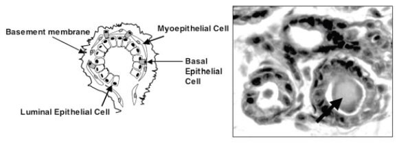 Diagram of a mammary acinus on left and a morphologically