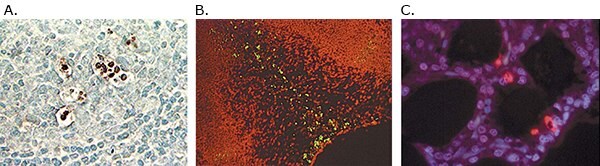 Detection of apoptotic cells