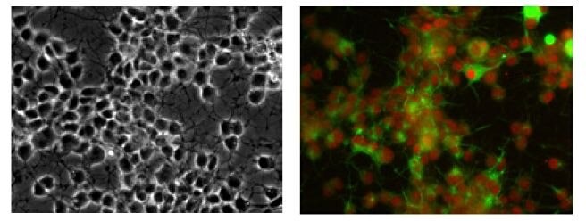 Brightfield image of rat NSCs cultured in the CellASIC® ONIX M04S Microfluidic Plate on Day 8 (Left)