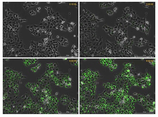 Time course of hypoxia in live cancer cells.