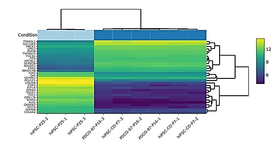 Fig 3: Heatmap of top 30 differentially expressed genes