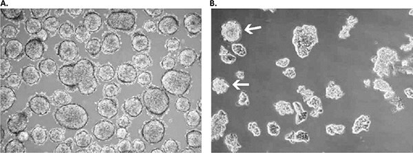 Primary culture derived from a low-grade small cell lung cancer with the Primary Cancer Culture System.