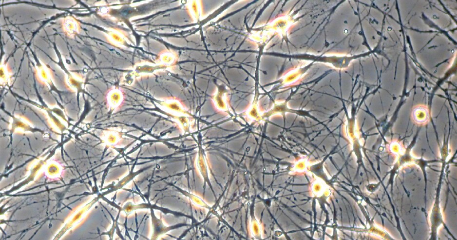 Neural differentiation of human MSCs.