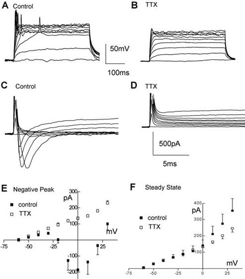 Electrophysiological properties of ReNcell CX