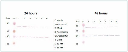 Western blot.