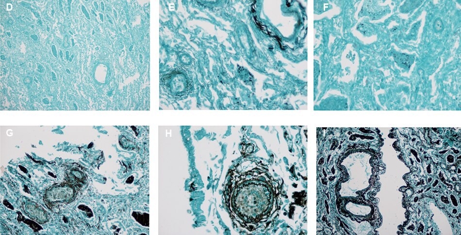 Micrographs of GMS staining with various water contaminants 