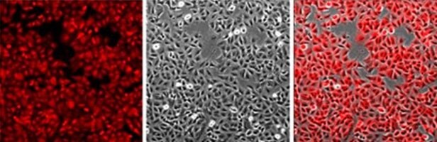 Imaging of A549 cells landing pad cell line