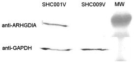 Human Positive Control #2, ARHGDIA shRNA