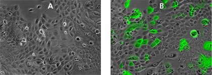 Primary keratinocytes transduced with MISSION®