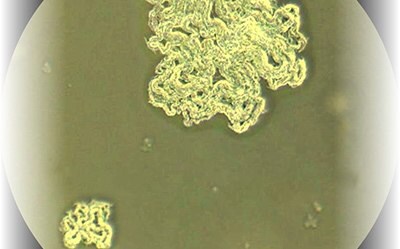 10x Magnification Mycobacterium Tuberculosis