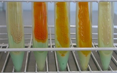 Different mycobacteria species grown on TB-Medium 