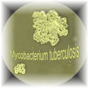 Typical colony of Mycobacterium tuberculosis seen under a microscope with 10x magnification