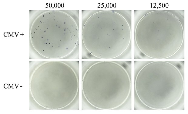 ELISpot assay using CMV-derived peptides to stimulate IFN-γ secretion.