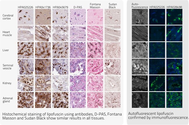 Collection of Proteins in Lipofuscin 