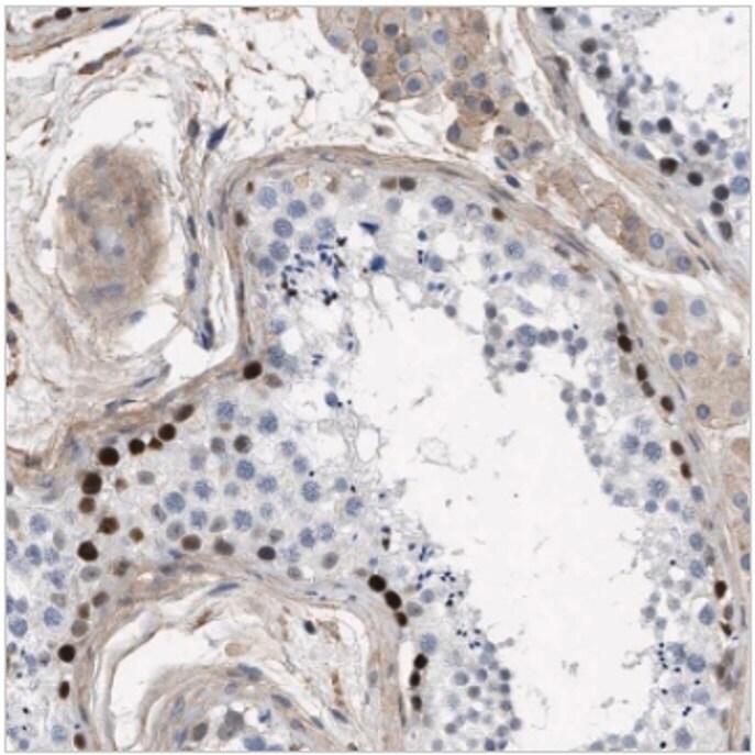 Immunohistochemical staining of human testis with anti-MAS1L polyclonal antibody (Cat. No. HPA017983) shows strong positivity in basal cells of ductus seminiferous.