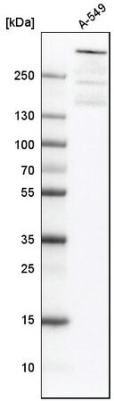 Western blot analysis using anti-ATRX antibody