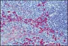 Colorimetric immunohistochemical detection of Alkaline Phosphatase