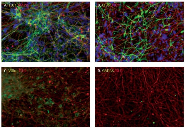 Neuronal differentiation of iPSC derived NPCs.