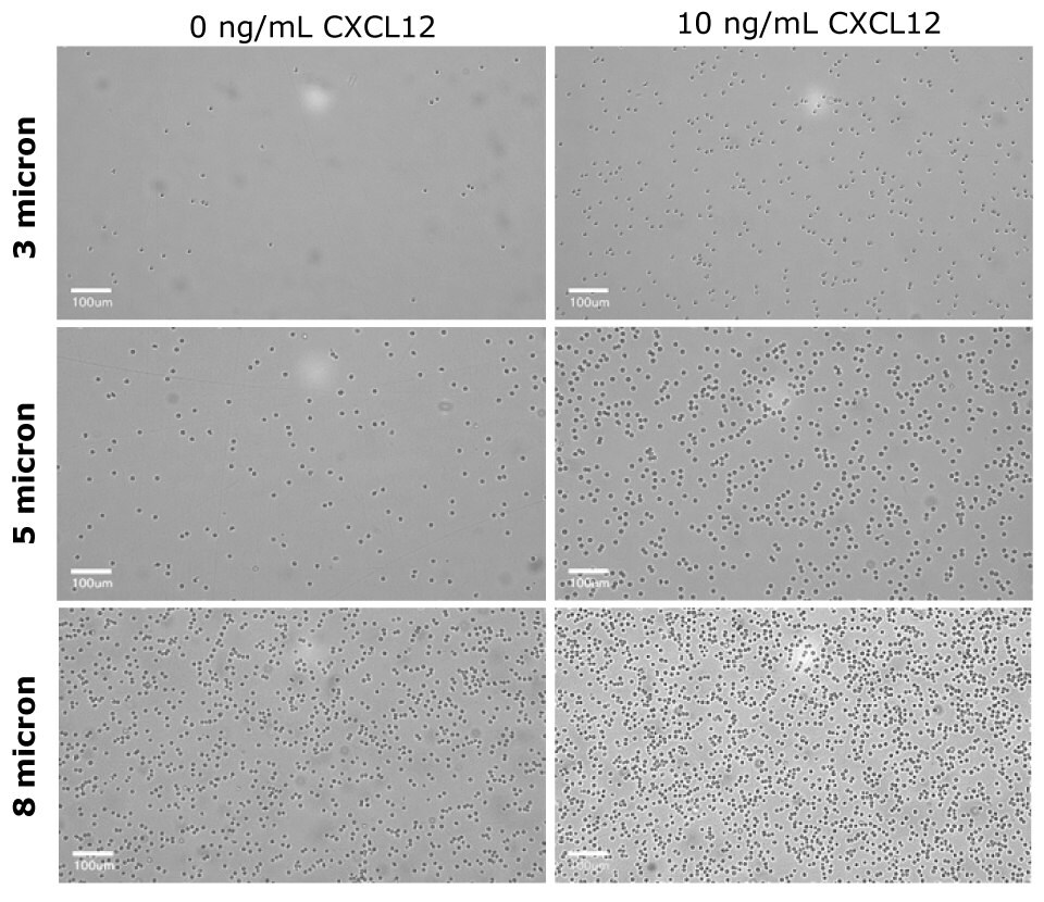 Microscopy images of cell migration of Primary CD4+ cells at different CXCL12 concentrations and insert pore sizes