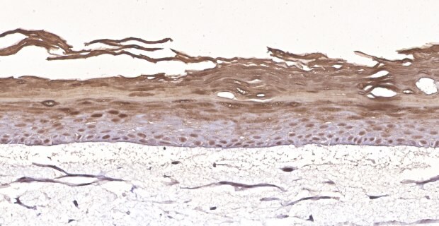 Organotypic skin models contain actively proliferating keratinocytes. (C)