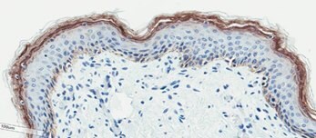 Neonatal Skin Tissue (D)