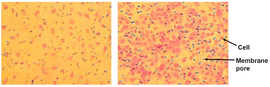 In vitro VEGF stimulated cell migration of endothelial cells