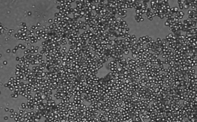 Microscopy image of hepatocytes forming spheroids after seeding and centrifugation. Dark grey rectangle with light grey dots across the surface indicating cells.