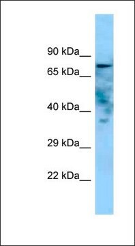 Anti-GOLIM4 antibody produced in rabbit affinity isolated antibody