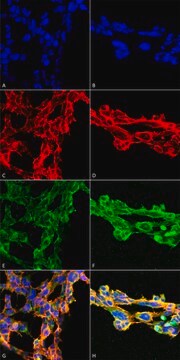 Monoclonal Anti-7-Ketocholesterol-FITC antibody produced in mouse clone 7E1