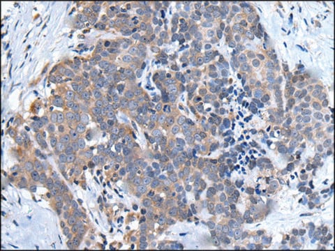 抗-UBQLN2 affinity isolated antibody