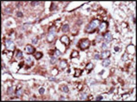 Anti-DGKZ (C-term) antibody produced in rabbit IgG fraction of antiserum, buffered aqueous solution