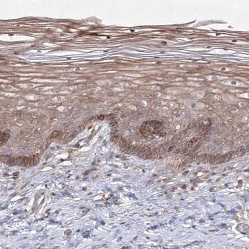 Anti-SH3PXD2A antibody produced in rabbit Prestige Antibodies&#174; Powered by Atlas Antibodies, affinity isolated antibody, buffered aqueous glycerol solution