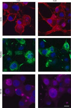 モノクロナール抗ニューロフィラメント160 マウス宿主抗体 clone NN18, ascites fluid