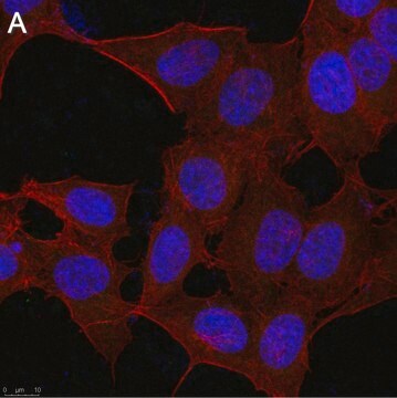 Anti-ATF4 Antibody, clone 1B21 ZooMAb&#174; Rabbit Monoclonal recombinant, expressed in HEK 293 cells