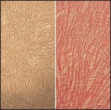 Human Umbilical Artery Smooth Muscle Cells: HUASMC, neonatal