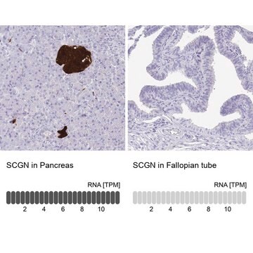 抗SCGN抗体 ウサギ宿主抗体 affinity isolated antibody, buffered aqueous glycerol solution