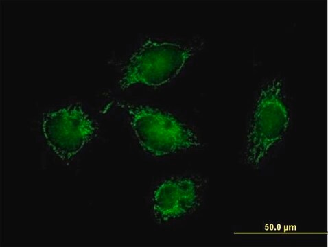 抗ATPIF1抗体 マウス宿主抗体 purified immunoglobulin, buffered aqueous solution