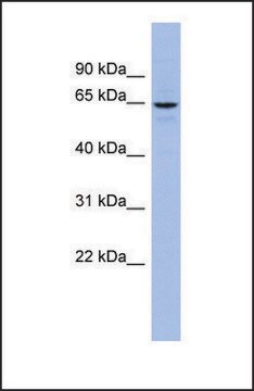 抗SLC34A3抗体 ウサギ宿主抗体 affinity isolated antibody