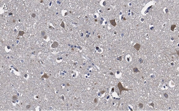 Anti-Stathmin-2 Antibody, clone 1B3 ZooMAb&#174; Rabbit Monoclonal recombinant, expressed in HEK 293 cells