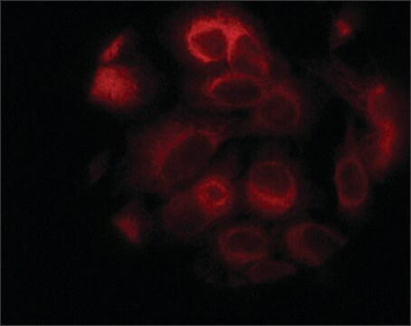 AntiSTIM1 (C-terminal) ~1&#160;mg/mL, affinity isolated antibody, buffered aqueous solution